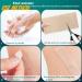 Silicone Scar Sheets 1.6 x 60 Roll for Surgical Keloid C-Section Burn Acne - Reusable Scar Removal Strips - Professional Scar Away Tape - Buy Online on GoSupps.com