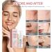 Mousse Nettoyante Visage 5 En 1: Nettoie Les Pores Profondeur Att nue Marques D'acn limine Points Noirs Contr le Le S bum Et Illumine La Peau(2PCS) - Buy Online on GoSupps.com