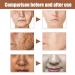 Buy Ages Solution Cream - Anti-Aging Dark Spot Remover Even Skin Tone Hydration & Elasticity - 20g - Buy Online on GoSupps.com