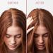 Umberto Giannini Scalp Rescue Anti Dandruff Hair and Scalp Mask - Vegan & Cruelty Free - 150ml - Buy Online on GoSupps.com