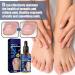 German Toenailcare Removal Paronychia Oil - Nail Renewal Liquid for Damaged Nails - Toenail Treatment Oil for Repair and Improve Toenail Health (2pcs) - Buy Online on GoSupps.com