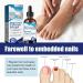 Ingrown Toenail Treatment - 30ML Ingrown Toenail Correction Drops - Nail Helper Ingrowth Toenail Treatment Oil - Trimming Toenail Softening Drops - Nail Fungal Treatment - Buy Online on GoSupps.com