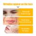 Smile Line Patches - 10pcs Collagen Hydrating Masks for Anti-Aging Smoothing Laugh Lines & Wrinkles - Buy Online on GoSupps.com