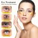 GNAPY 24K Gold Collagen Under Eye Masks - 30 Pairs | For Puffy Eyes, Dark Circles & Bags | Cooling Gel Pads for Fine Wrinkles, Hydration & Elasticity - Buy Online on GoSupps.com