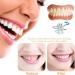 Yunpso Denture Silicone Reline Kit - Comfortable Teeth Veneers for Men & Women | International Shipping Available - Buy Online on GoSupps.com