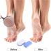 Pumice Stone Set for Feet | Callus Remover Scrubber Pedicure Exfoliator Tool | Double Sided Glass Pumice Stone | Smooths Skin on Feet, Hands, and Body - Blue - Buy Online on GoSupps.com