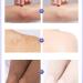 New Magical Whitening Body Lotion Whole Body Cold White Skin Cold White Full Body Whitening Cream New Cold White Skin All Over Whitening Nourishing Body Lotion For All Skin Types(200g 1pc) - Buy Online on GoSupps.com