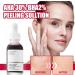 AHA 30% + BHA 2% Peeling Solution AHA Exfoliating Facial Serum BHA Face Serum for Women Soothing Skincare Serum for Face Peeling Brightening Serum for Fighting Blemishes & Reduces Pore Congestion - Buy Online on GoSupps.com