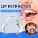 CRAKES 6 Pack Dental Lips | Autoclavable Whitening & Cheek Stretcher Mouth Opener for Dentists - International Shipping Available - Buy Online on GoSupps.com