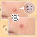 AUSLKA Panda Pimple Patches 120 Count - Hydrocolloid Spot Dots for Face Acne Absorbing Cover Patch - Blemishes and Pimple Stickers for Clear Skin - Pack of 1 - Buy Online on GoSupps.com