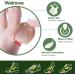 Welnove 36 CT Bunion Cushions Pad - Fabric Toe and Foot Bunion Protector for Bunion Relief and Reduce Rubbing - Strong Adhesive Bunion Relief Pads - Buy Online on GoSupps.com