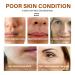 Retinol Facial Essence Gentle Moisturizing Replenishing Moisture Pore Minimizing Evening Skin Facial Serum 30ml - Buy Online on GoSupps.com