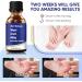 NNR Liquid Wart Remover - Fast Acting Plantar Wart Treatment for Feet - Gel Formula for All Skin Types - Buy Online on GoSupps.com