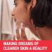 Stubborn Blackheads Daily Cleanser AHA Salicylic Acid Acne Treatment Glycolic + Mandelic + Polyhydroxy Acids Fragrance Free - Buy Online on GoSupps.com