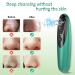 Blackhead Remover Pore Vacuum with Camera - Rechargeable Blackhead Suction Tool for Face and Nose - Skin Acne Pimple Cleaner for Men and Women - Buy Online on GoSupps.com