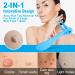 Painless 2-in-1 Skin Tag Removal Kit for Micro to Large Skin Tags (1-9mm) - Safe & Easy DIY Tool for Home Use - Buy Online on GoSupps.com