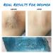 Lemontra Waxing Kit for Hair Removal - Home Wax Machine with Hard Wax Beads for Brazilian Bikini, Eyebrow, Leg, Armpit, Facial - Women Men - Buy Online on GoSupps.com