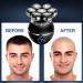 7D Electric Head Shaver for Bald Men | 6-in-1 Wet/Dry Razor for Face & Head | Men's Grooming Kit with Beard/Nose Trimmer | Wireless Charging Base | Black - Buy Online on GoSupps.com