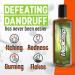 Medicasp Coal Tar Gel Dandruff Shampoo 6oz - Seborrheic Dermatitis & Psoriasis Treatment - Buy Online on GoSupps.com