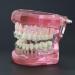 Buy Dental Orthodontic Teeth Model with Metal & Ceramic Brackets - Ideal for Study & Research | International Shipping Available - Buy Online on GoSupps.com
