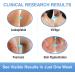 Vitiligo Cream for Skin Treatment and Pigmentation Care - Buy Online on GoSupps.com