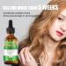 Organic Rosemary Oil for Hair Growth | Healing Solutions - 2.11 fl oz | Improves Scalp Circulation & Eliminates Dry Scalp for Women | Komsoup - Buy Online on GoSupps.com