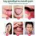 Mouth Ulcer Treatment Spray Mouth Ulcer Spray Canker Sore Treatment for Adults Oralcare Propolis Ulcer Relief Spray Herbal Mouth Spray Canker Relief Spray Breath Spray for Bad Breath Breath Freshener - Buy Online on GoSupps.com