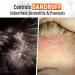 Medicasp Coal Tar Gel Dandruff Shampoo 6oz - Seborrheic Dermatitis & Psoriasis Treatment - Buy Online on GoSupps.com