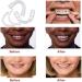 Regain Confidence with 2 Pairs of Smile Enhancers for Men & Women - Shop Internationally - Buy Online on GoSupps.com