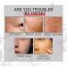 Leideli Collagen Firming Serum Leideli Collagen Boost Anti Aging Serum Collagen Booster Serum FaceEelhoe Collagen Boost Anti Aging Serum For All Skin Type (3 pcs) - Buy Online on GoSupps.com