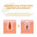 Blackhead Removal Nose Patches - Deep Cleansing Pore Strips for Instant Unclogging & Oil Removal (20 Patches - Buy Online on GoSupps.com