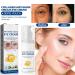 Jasmine Ointment - Dark Circle Removal & Eye Care Cream for All Skin Types (3PCs) | Active Jasmine Formula for Tear Bags & Eye Corn Loop - Buy Online on GoSupps.com