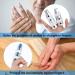 Metal Padded Finger Splints with Loop Straps - 10 Piece Assortment in 3 Sizes (Blue) - Finger Support for Adults and Children - Buy Online on GoSupps.com