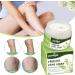 Varicose Vein Cream for Soothing Relief and Improved Capillary Health - Buy Online on GoSupps.com