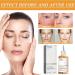 7% Glycolic Acid Toning Solution Glycolic Sour 7 Toner Glycolic Acid Toning Solution Glycolic Acid 7% Toning Resurfacing Solution Glycolic Acid Toner Glycolic Acid Hydrating Toner - Buy Online on GoSupps.com