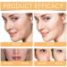 Glycolic Acid Toner 7% Glycolic Acid Toning Resurfacing Solution - Hydrating Exfoliating Toner for Clear and Smooth Skin Reduces Large Pores & Acne Brightens and Strengthens 100ml - Buy Online on GoSupps.com