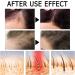 Lot de 14 ampoules de s rum capillaire pour la croissance et la r g n ration des cheveux - Huile hydratante pour cheveux fins ab m s secs mats et cassants - Buy Online on GoSupps.com