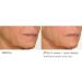 NassifMD Night Therapy Serum - Revitalize Skin Overnight | Shop Internationally - Buy Online on GoSupps.com