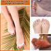 2 Pairs Soft Silicone Toe Separators for Men and Women - Toe Spacers for Crooked Toes, Hammertoes, Bunions - Foot Strengthening and Balance Tools - Buy Online on GoSupps.com