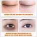 Fast Absorption Eye Care Dehydrated Skin Cream Dry Skin Eye Care Dull Skin Moisturizer Oily Skin Eye Cream Firming Eye Hydrating Eye Cream Eye Care Moisturizer - Buy Online on GoSupps.com