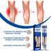 Natural Varicose Veins Relief Cream for Legs - Spider Vein & Varicose Vein Treatment - Buy Online on GoSupps.com
