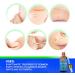 Liquid Wart Remover | Fast-Acting Advanced Treatment for All Wart Types - Painless Solution for Common & Genital Warts - International Shipping Available - Buy Online on GoSupps.com