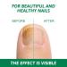 30ml Fast-Acting Toenails Treatment - Strengthen & Protect Brittle Nails | No Filing Needed - Buy Online on GoSupps.com