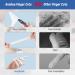 Annhua Latex Finger Cots 150pcs - Disposable Finger Covers for Hospitals & Beauty Salons | Waterproof, Anti-Static, White 100g - Buy Online on GoSupps.com