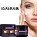 Scar Removal Cream 50ml - C-Section Skin Repair, Stretch Marks & Acne Surgery Treatment - Buy Online on GoSupps.com