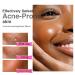 Salicylic Acid Acne Spot Removal Cream - Control Breakouts Clear Pimples & Blackheads | 1.76 oz Refreshing Formula for Acne-Prone Skin - Buy Online on GoSupps.com