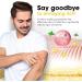 Chinese Herbal Eczema Treatment Cream - Sensitive Skin Relief (3pcs) - Buy Online on GoSupps.com