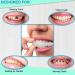 Temporary Tooth Fake Teeth for Missing Teeth - Instant DIY Smile Makeover - Buy Online on GoSupps.com
