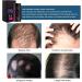Hair Thickening Fibers 0.4 Oz Hair Building Fiber Thickening Hair Fiber Powder for Women and Men Natural Black - Buy Online on GoSupps.com
