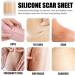 Teksome Scar Tape for Body - 1.5m Stretch Mark Remover Strips | Silicone Gel Tape for Scars & Stretch Marks - Buy Online on GoSupps.com